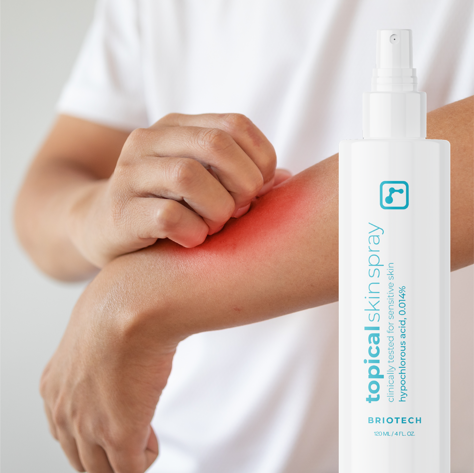 Topical Skin Spray (Wholesale)