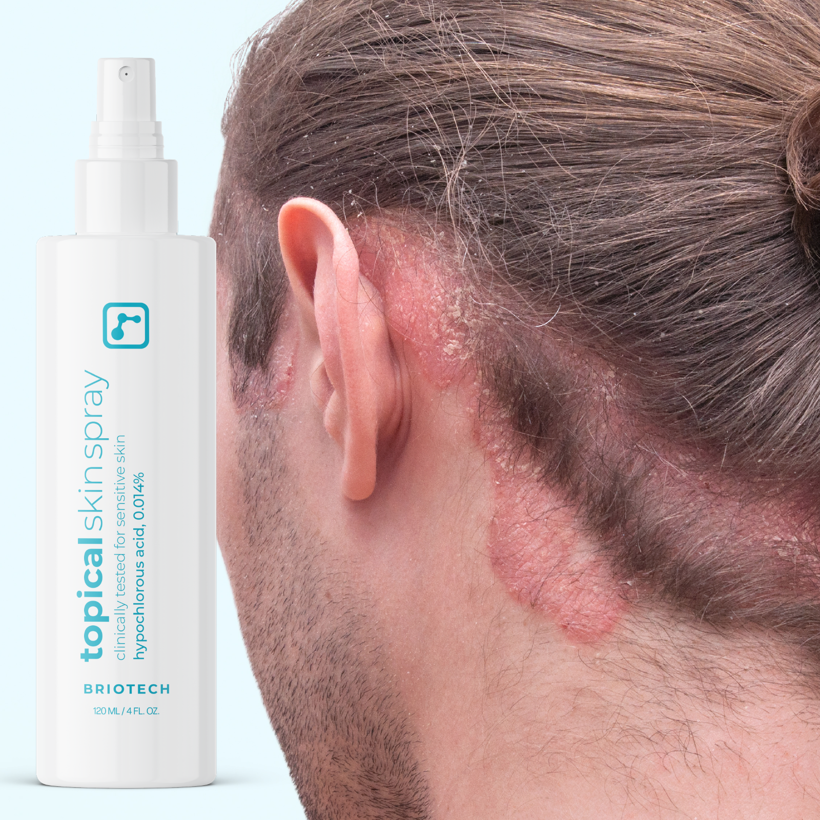 Topical Skin Spray (Wholesale)